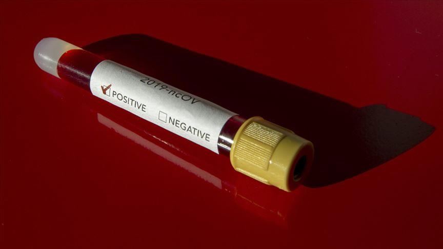 Confirmed COVID-19 cases rise in Egypt, Saudi Arabia