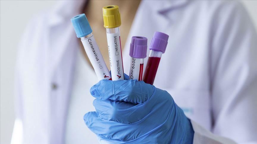 République turque de Chypre du Nord: Une touriste allemande positive au coronavirus