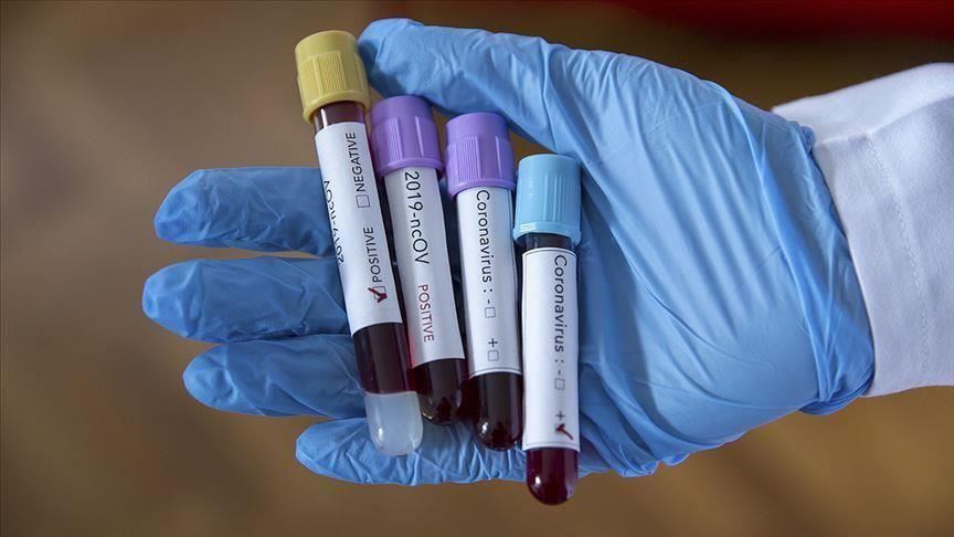 DR Congo confirms first coronavirus case