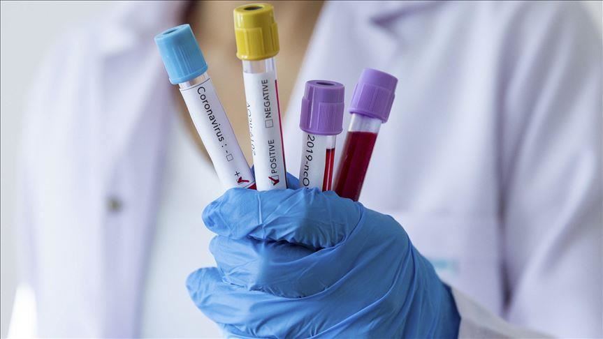 Konfirmohen 31 raste me koronavirus në Serbi