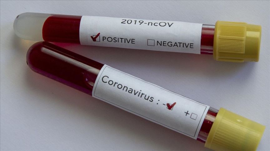 Alcalde de Miami confirma tener coronavirus después de encuentro con delegación brasileña