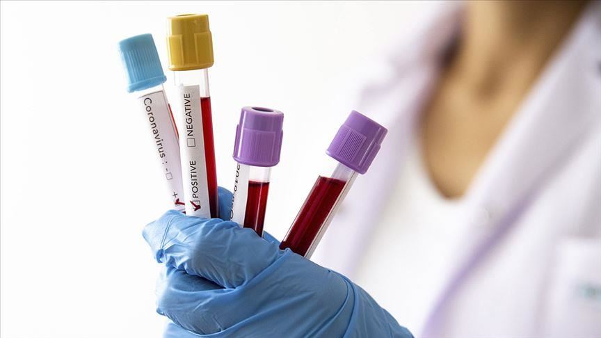 Northern Cyprus confirms 6th coronavirus case