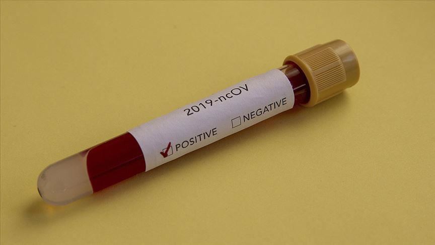 Zambia confirms first 2 coronavirus cases