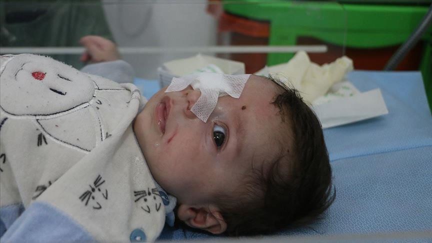2-month-old Syrian lost eye in regime attack