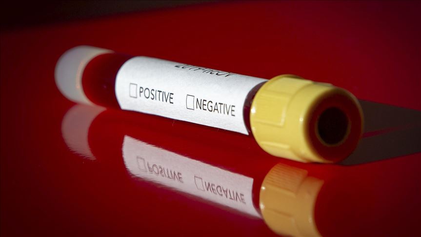 Uganda announces sweeping measures against coronavirus