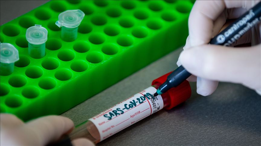 Panamá usa equipos de pruebas para el VIH para diagnosticar ...