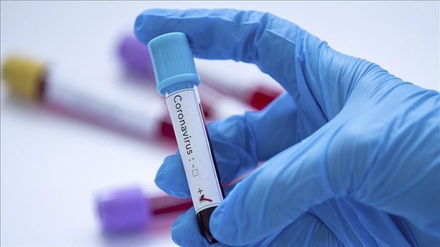 Coronavirus: Gabon confirms first COVID-19 death case