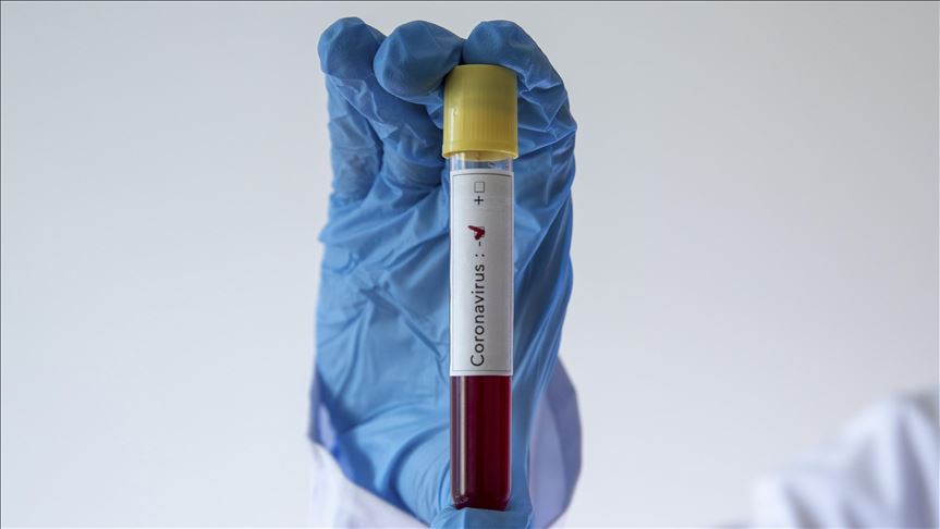 Zimbabwe Reports First Covid 19 Case