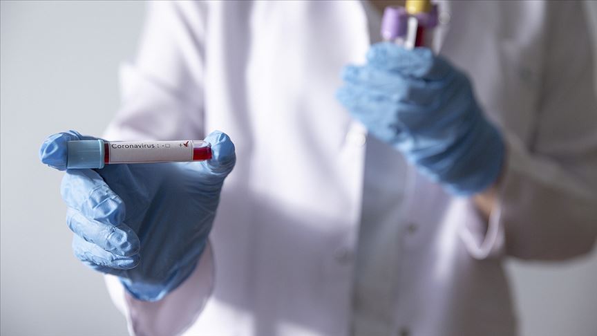 Türkiye Kolombiya’ya 26 bin Kovid-19 tanı testi gönderdi