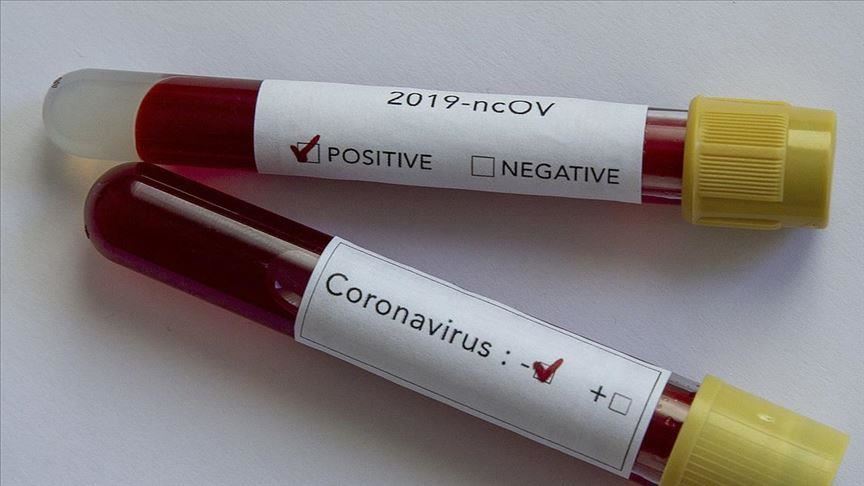 Mali, Guinea-Bissau confirm 1st coronavirus cases