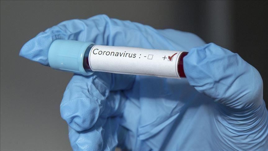 RCA/Coronavirus: Un expert onusien met en garde contre une "catastrophe sanitaire"
