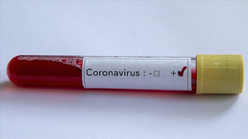 COVID-19 cases in Southern Cyprus jump to 214