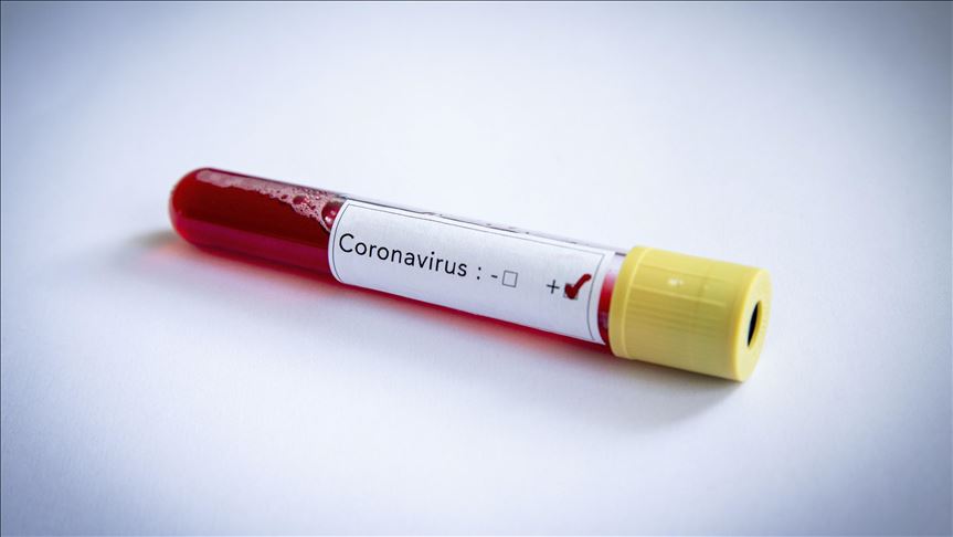 Prvi smrtni slučaj od koronavirusa u Obali Slonovače 