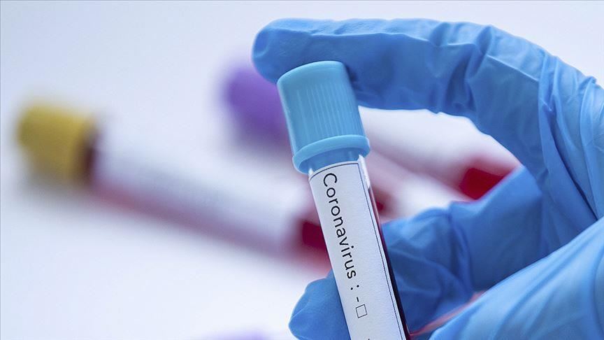 Coronavirus: Angola reports first 2 deaths