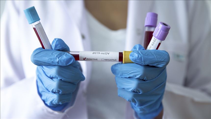 U Izraelu još tri osobe preminule od zaraze koronavirusom