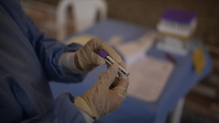 Investigadores de Colombia aíslan el virus causante del COVID-19 en un tubo de ensayo