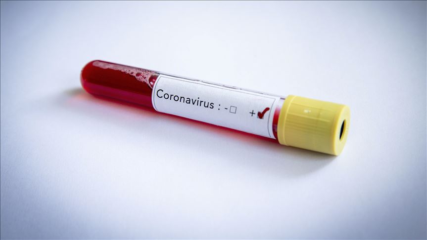Na Kosovu novi smrtni slučaj od koronavirusa