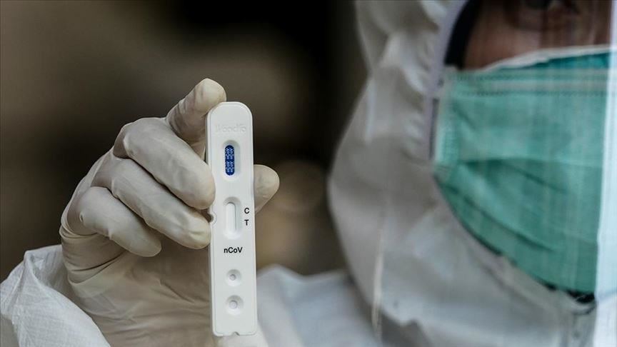 Le bilan des contaminations par le Covid-19 dépasse 1 400 000 cas à travers le monde 