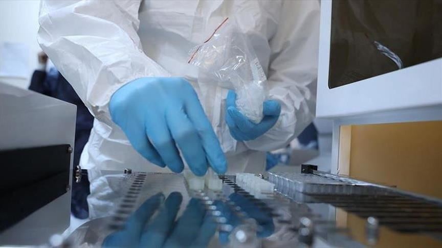 Covid-19 : le Cameroun se lance dans la fabrication industrielle de la chloroquine