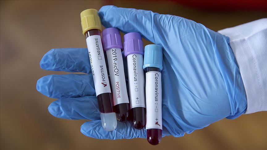 Turkey's COVID-19 cases expected to drop in May: Expert
