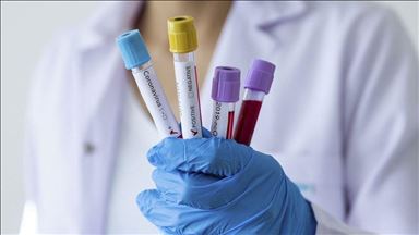 Coronavirus cases rise in 5 Arab countries