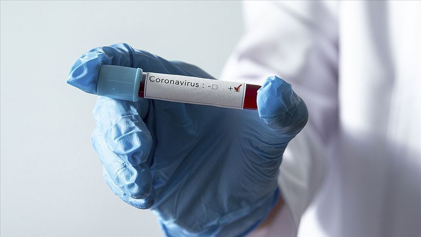 Dünya genelinde Kovid-19 vaka sayısı 1 milyon 700 bini aştı