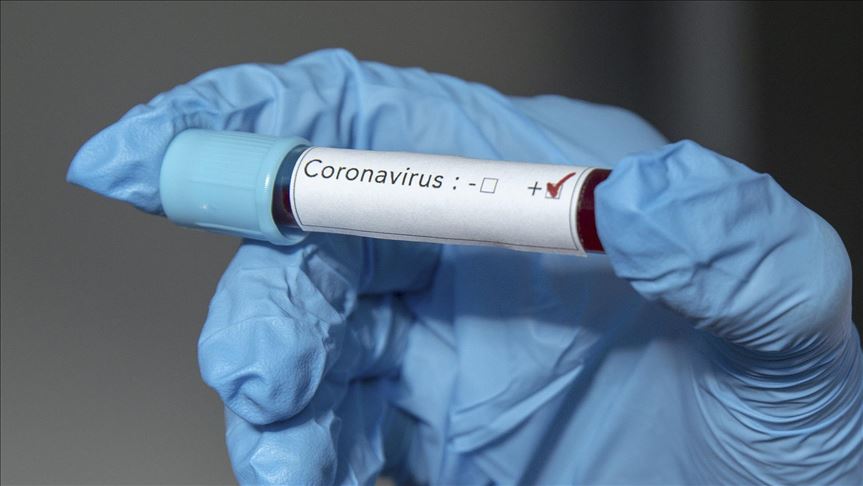 EEUU necesitará 20 millones de pruebas diarias de coronavirus para reabrir la economía
