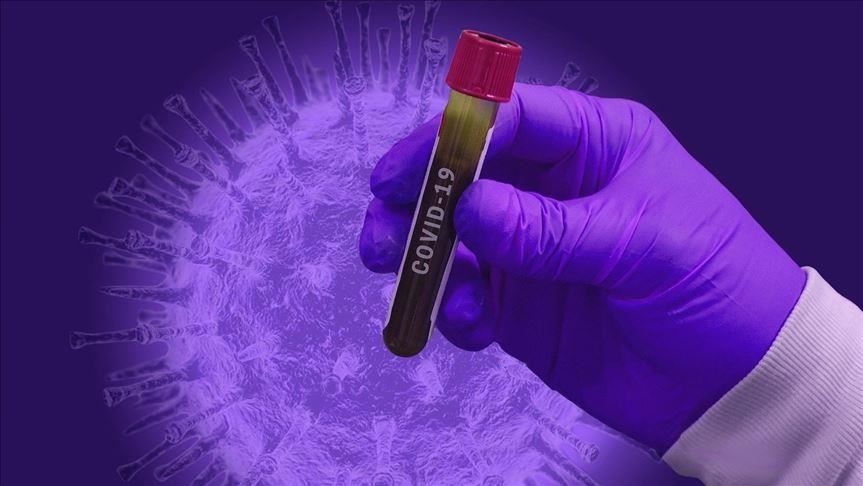 Eurasian countries fighting pandemic