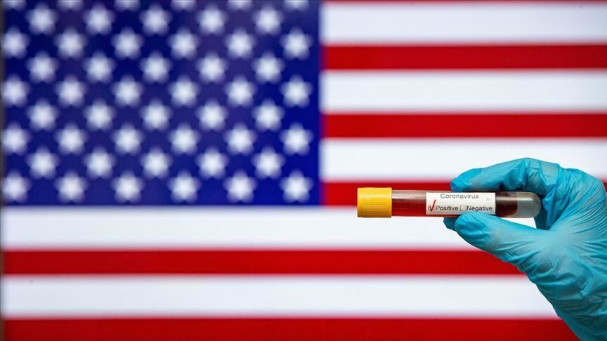 États-Unis : le nombre de contaminations au nouveau coronavirus dépasse la barre d’un million