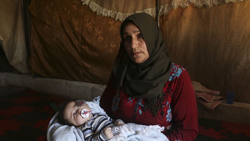 أم سورية تناشد لمساعدة طفلها قبل فقدان عينه (تقرير) 