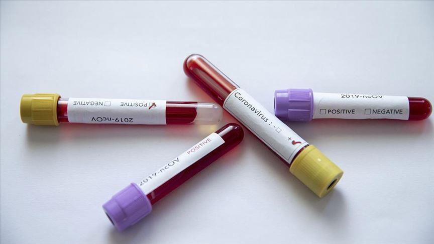 Plus aucun cas actif de nouveau coronavirus sur l'Île Maurice