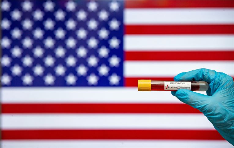 US coronavirus death toll tops 90,000