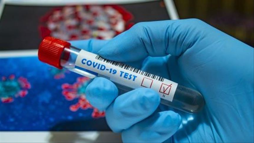 Madagascar records its first coronavirus death
