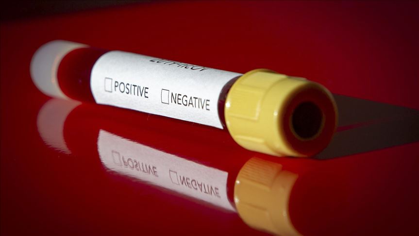 Preporuka Vladi Srbije: Ulazak u zemlju bez testa na koronavirus