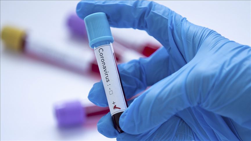Crna Gora: Registrovan importovani slučaj koronavoruisa