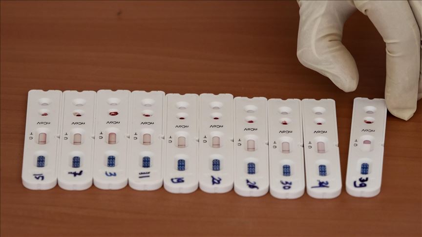 Srbija: Ulazak u zemlju bez testa na koronavirus