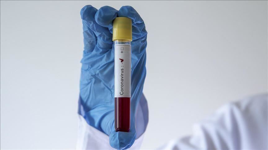 BiH: U Kantonu Sarajevo nema novih pozitivnih osoba na koronavirus