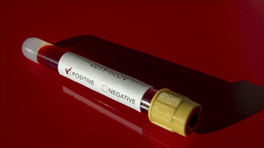 Coronavirus cases continue to rise in Peru