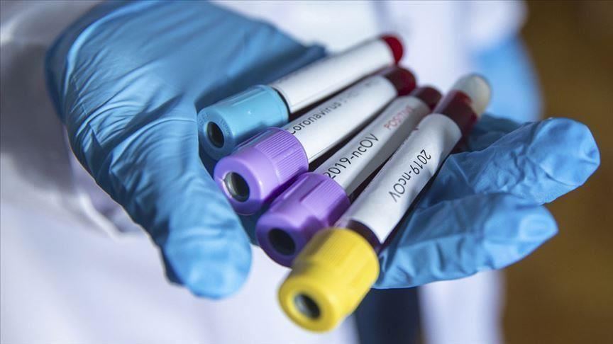 BiH: U RS-u još 11 osoba pozitivno na koronavirus