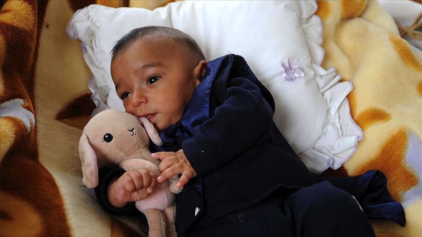 Premature Bebek Annelerinin Merak Ettigi 10 Soru Saglik Haberleri