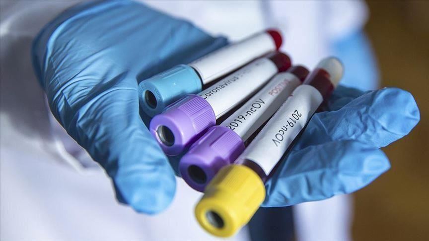 Pemerintah imbau pasien sembuh Covid-19 donorkan plasma darah