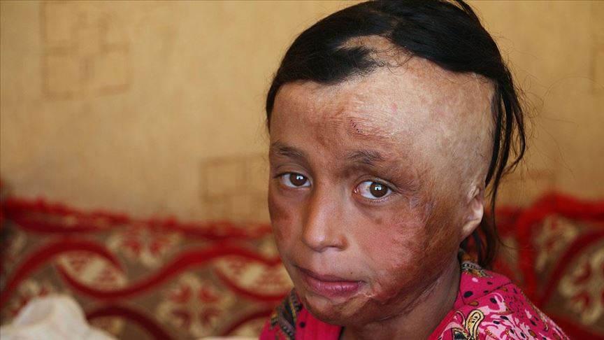 Ic Savasin Silinmeyen Hafizasi Suriyeli Cocuklar