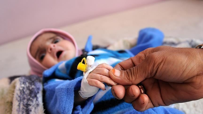 الأمم المتحدة: ‏أكثر من 20 مليون يمني يعانون الجوع المزمن 