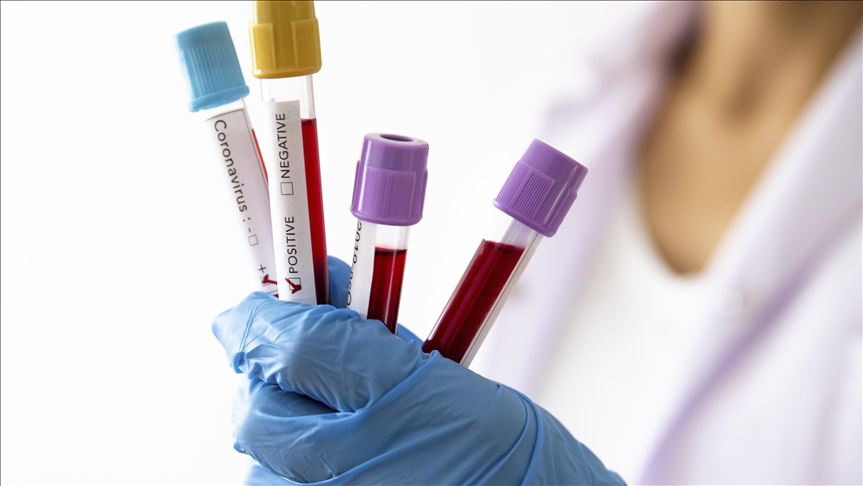 Peru records highest daily coronavirus death toll