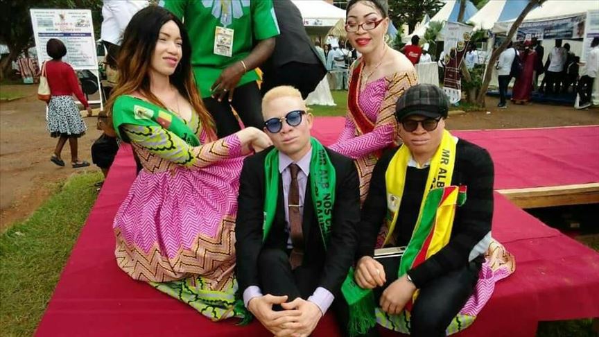 Albinos in Cameroon raise awareness through excellence