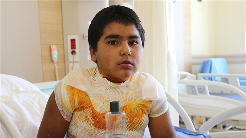 Merakli Cocugun Kolonya Ve Cakmakla Tehlikeli Oyunu Kabusu Oldu