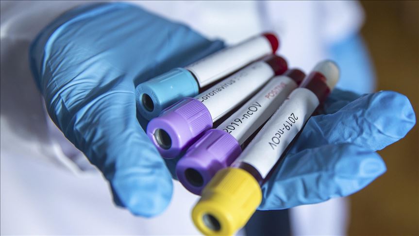 Crna Gora: Registrovano 47 novih slučajeva koronavirusa, jedan pacijent preminuo