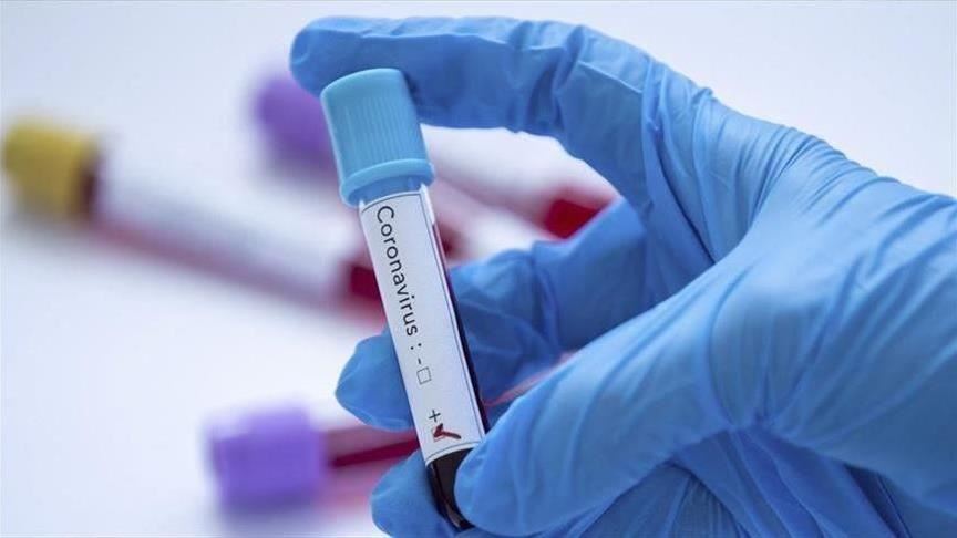 BiH: Na koronavirus pozitivno još 58 osoba u RS-u