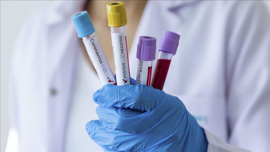 Crna Gora: Registrovano 57 novih slučajeva koronavirusa