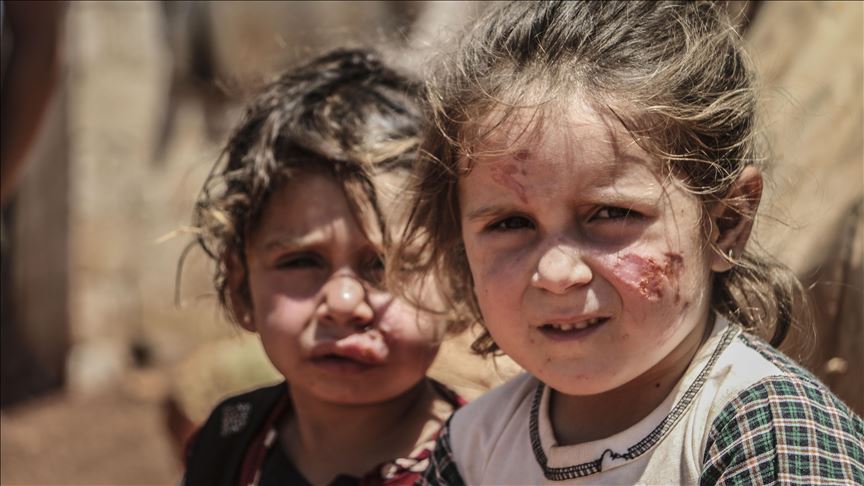 Syrie : la "leishmaniose cutanée" se propage dans les camps de réfugiés d'Idleb
